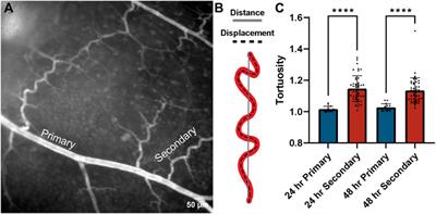 Evaluating cell viability, capillary perfusion, and collateral tortuosity in an ex vivo mouse intestine fluidics model